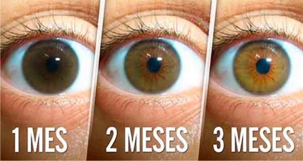 avoid-surgery-very-simple-natural-remedy-that-reduces-cataract