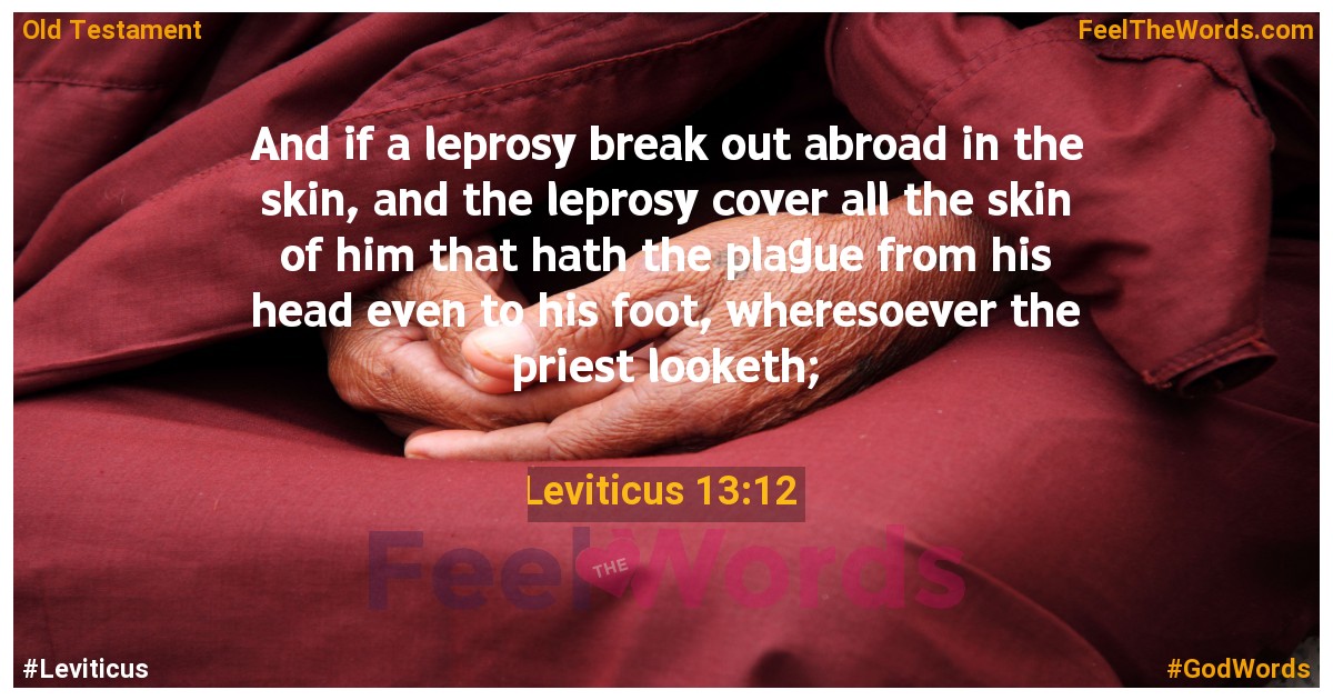 Leviticus 13:12