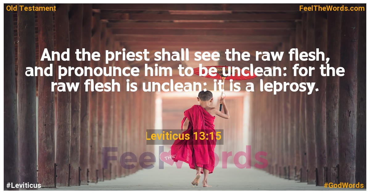 Leviticus 13:15