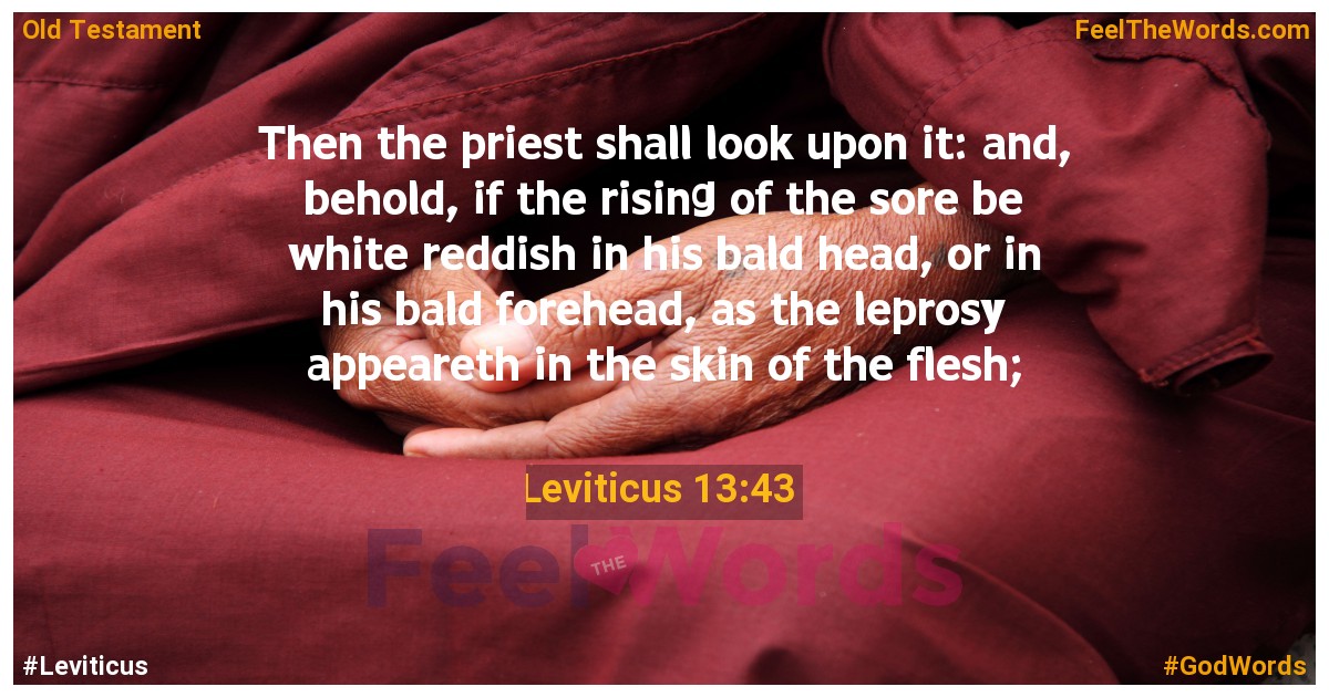 Leviticus 13:43